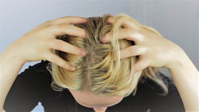 880429_web1_gtr-hth-dandruff-01-031919