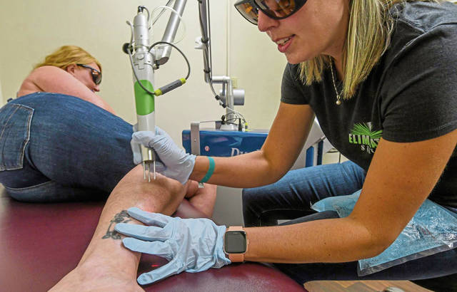 1402824_web1_VND-TattooRemovel2-072219
