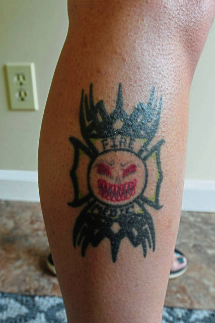 1402824_web1_VND-TattooRemovel3-072219