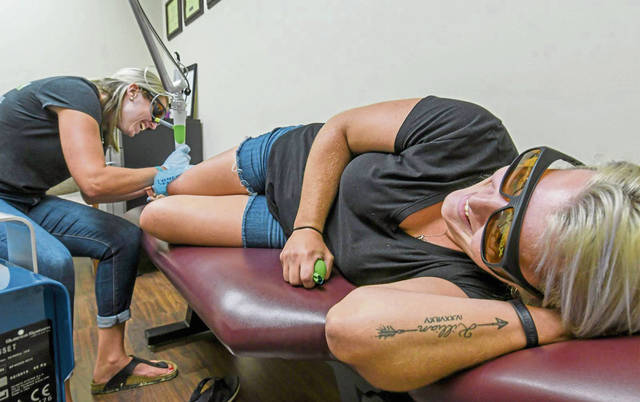 1402824_web1_VND-TattooRemovel5-072219