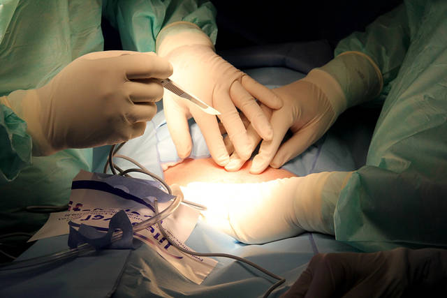 1536337_web1_SurgeryA