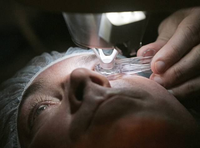 2102435_web1_web-LASIK-00 2102435_web1_web-LASIK-00