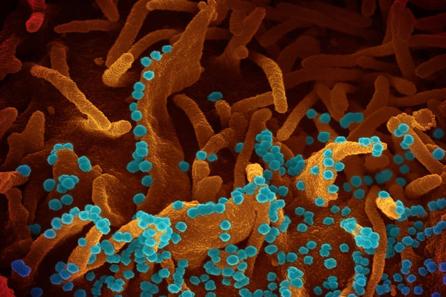 2782608_web1_US-NEWS-CORONAVIRUS-CELLS-4-MCT