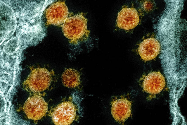 Scientists: Hong Kong man got coronavirus a 2nd time