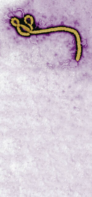4287852_web1_ptr-EBOLAillo-100514