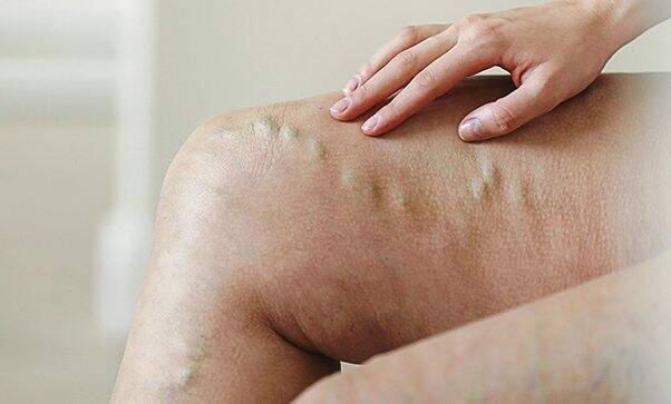 5803148_web1_part-threeriversveincentercond-011623