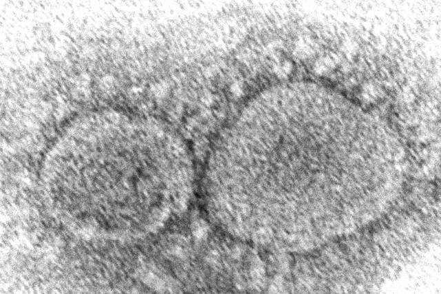 5953693_web1_5953693-36ca40f8a2d245bca7ab9988139cb211