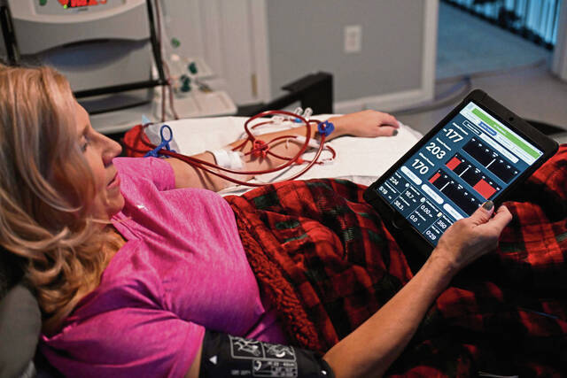 7871993_web1_gtr-dupilkadialysis005-102924