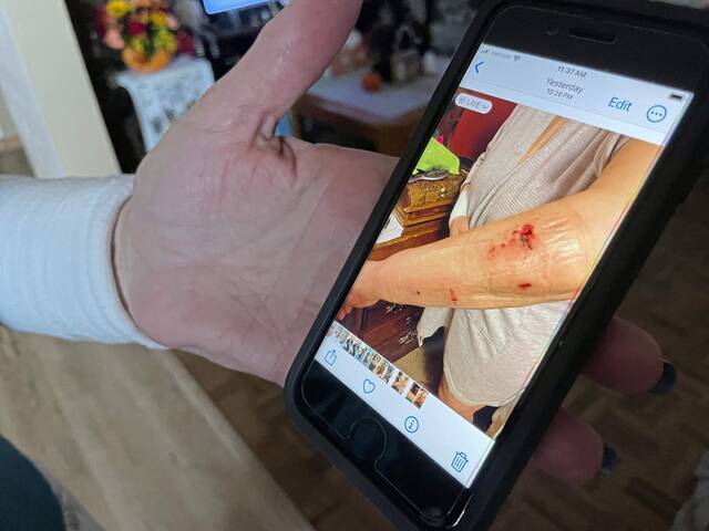 7898793_web1_vnd-dogbite2-110324