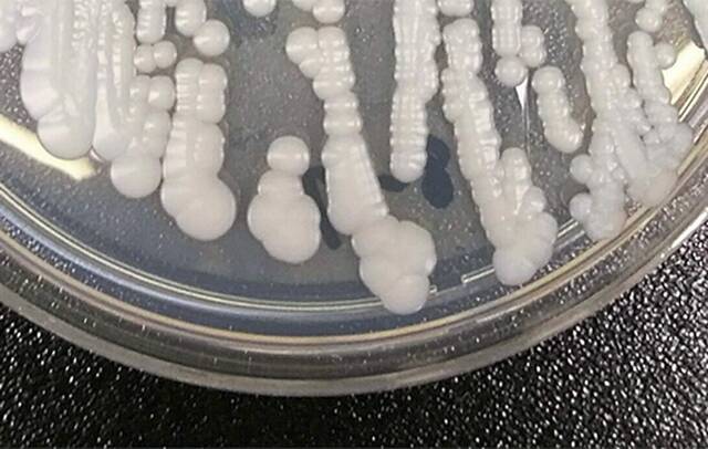 8349733_web1_ptr-CDCFungus-032825