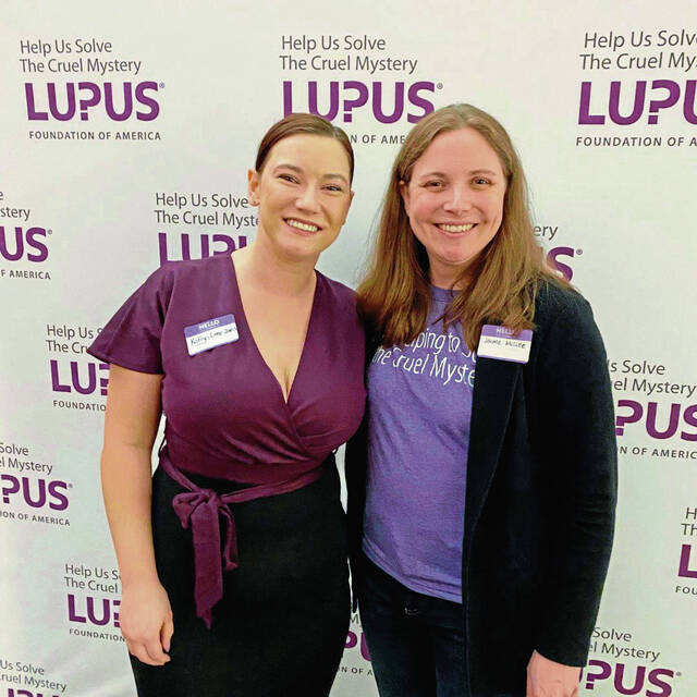 8302291_web1_Lupus-2